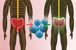 Intestinal flora from twins is able to initiate multiple sclerosis